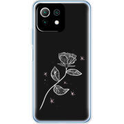 Чехол BoxFace  Xiaomi 11 Lite 5G NE 