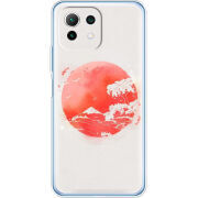 Чехол BoxFace  Xiaomi 11 Lite 5G NE 