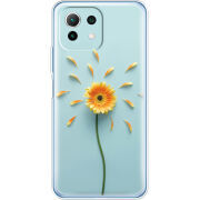Чехол BoxFace  Xiaomi 11 Lite 5G NE 