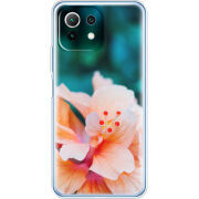 Чехол BoxFace  Xiaomi 11 Lite 5G NE 