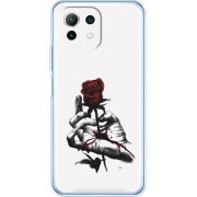 Чехол BoxFace  Xiaomi 11 Lite 5G NE 
