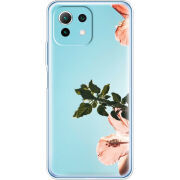 Чехол BoxFace  Xiaomi 11 Lite 5G NE 