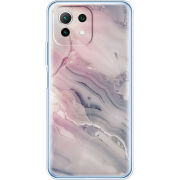 Чехол BoxFace  Xiaomi 11 Lite 5G NE 