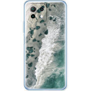 Чехол BoxFace  Xiaomi 11 Lite 5G NE 