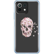 Чехол BoxFace  Xiaomi 11 Lite 5G NE 