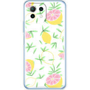 Чехол BoxFace  Xiaomi 11 Lite 5G NE 