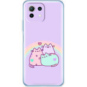 Чехол BoxFace  Xiaomi 11 Lite 5G NE 
