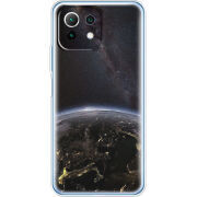 Чехол BoxFace  Xiaomi 11 Lite 5G NE 