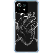 Чехол BoxFace  Xiaomi 11 Lite 5G NE 