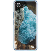 Чехол BoxFace  Xiaomi 11 Lite 5G NE 