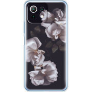 Чехол BoxFace  Xiaomi 11 Lite 5G NE 