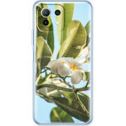 Чехол BoxFace  Xiaomi 11 Lite 5G NE 