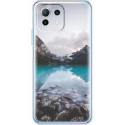 Чехол BoxFace  Xiaomi 11 Lite 5G NE 