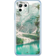 Чехол BoxFace  Xiaomi 11 Lite 5G NE 