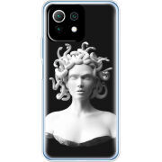 Чехол BoxFace  Xiaomi 11 Lite 5G NE 