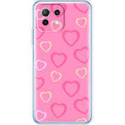 Чехол BoxFace  Xiaomi 11 Lite 5G NE Sugar Hearts