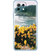 Чехол BoxFace  Xiaomi 11 Lite 5G NE 