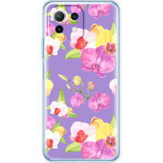 Чехол BoxFace  Xiaomi 11 Lite 5G NE 