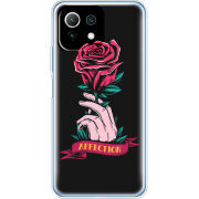 Чехол BoxFace  Xiaomi 11 Lite 5G NE 