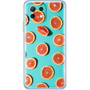 Чехол BoxFace  Xiaomi 11 Lite 5G NE 