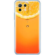 Чехол BoxFace  Xiaomi 11 Lite 5G NE 