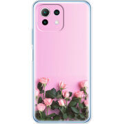 Чехол BoxFace  Xiaomi 11 Lite 5G NE 