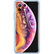 Чехол BoxFace  Xiaomi 11 Lite 5G NE 