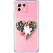 Чехол BoxFace  Xiaomi 11 Lite 5G NE 