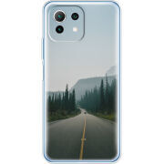 Чехол BoxFace  Xiaomi 11 Lite 5G NE 