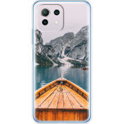 Чехол BoxFace  Xiaomi 11 Lite 5G NE 