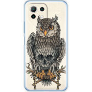 Чехол BoxFace  Xiaomi 11 Lite 5G NE 