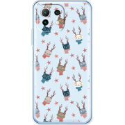 Чехол BoxFace  Xiaomi 11 Lite 5G NE 