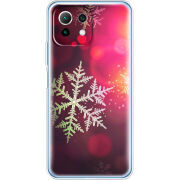 Чехол BoxFace  Xiaomi 11 Lite 5G NE 