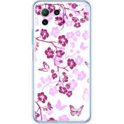 Чехол BoxFace  Xiaomi 11 Lite 5G NE 