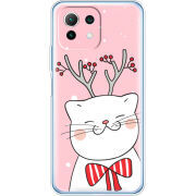 Чехол BoxFace  Xiaomi 11 Lite 5G NE 