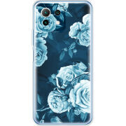 Чехол BoxFace  Xiaomi 11 Lite 5G NE 