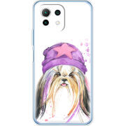 Чехол BoxFace  Xiaomi 11 Lite 5G NE 