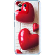 Чехол BoxFace  Xiaomi 11 Lite 5G NE 