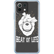 Чехол BoxFace  Xiaomi 11 Lite 5G NE 