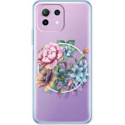Чехол BoxFace  Xiaomi 11 Lite 5G NE 