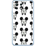 Чехол BoxFace  Xiaomi 11 Lite 5G NE 