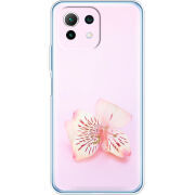 Чехол BoxFace  Xiaomi 11 Lite 5G NE 