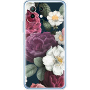 Чехол BoxFace  Xiaomi 11 Lite 5G NE 