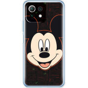 Чехол BoxFace  Xiaomi 11 Lite 5G NE 