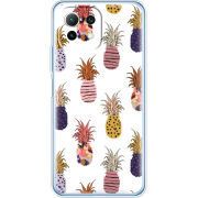 Чехол BoxFace  Xiaomi 11 Lite 5G NE 