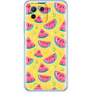 Чехол BoxFace  Xiaomi 11 Lite 5G NE 