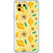 Чехол BoxFace  Xiaomi 11 Lite 5G NE 