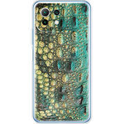 Чехол BoxFace  Xiaomi 11 Lite 5G NE 