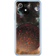 Чехол BoxFace  Xiaomi 11 Lite 5G NE 