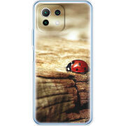 Чехол BoxFace  Xiaomi 11 Lite 5G NE 